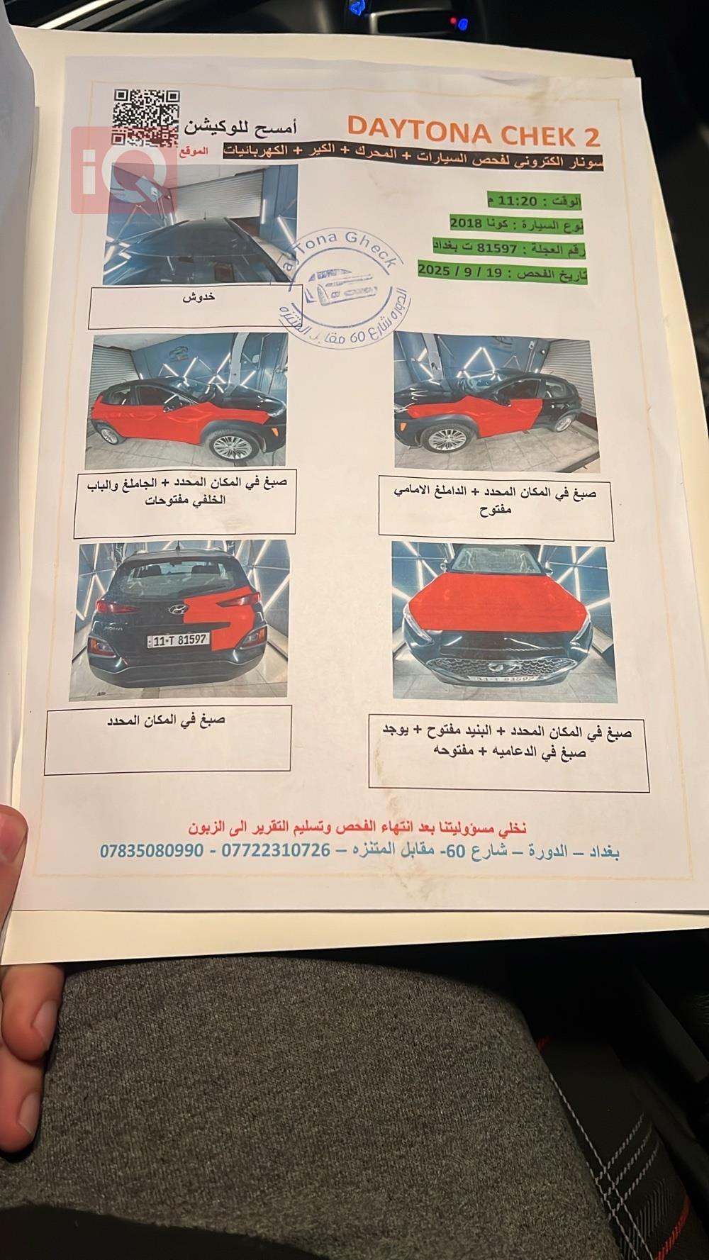 هيونداي كونا